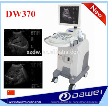 Ultraschall für Schwangerschaft und Ultraschall-Scan-Maschine Wagen DW370